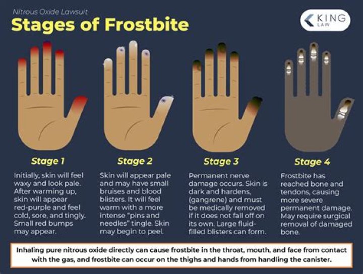 Can the effects of a stroke get worse over time?