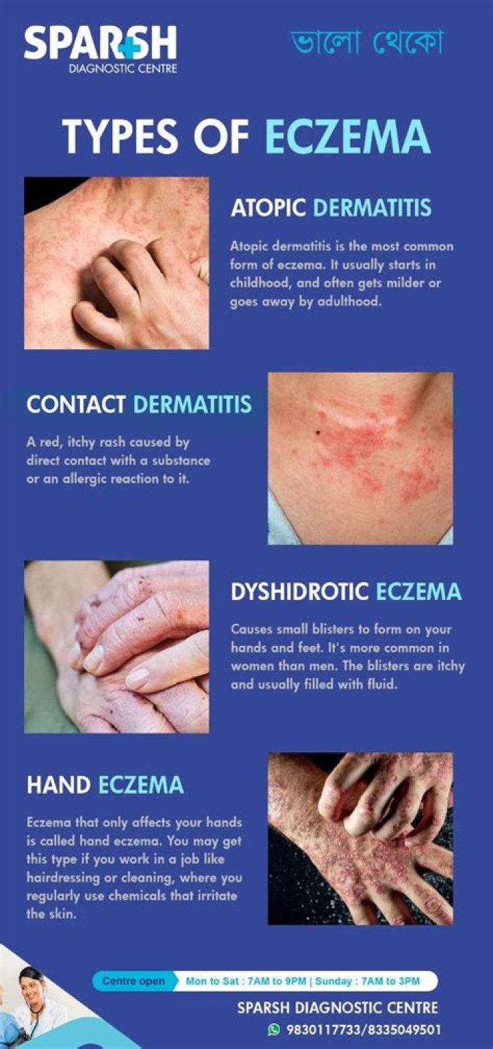 Can tomatoes aggravate eczema?
