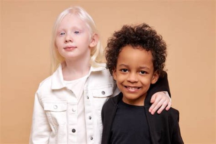 Can two albinos have a normal child?