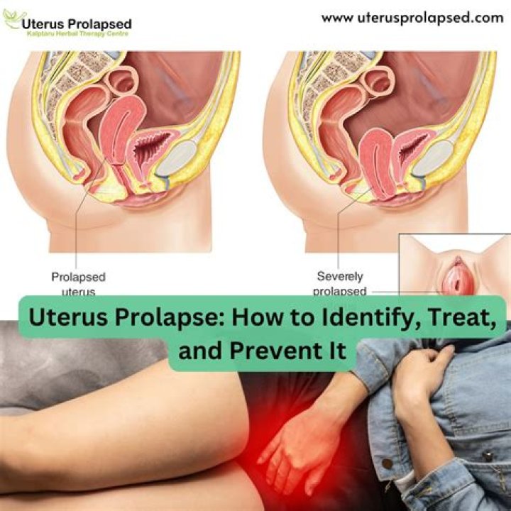 Can uterine prolapse fix itself?