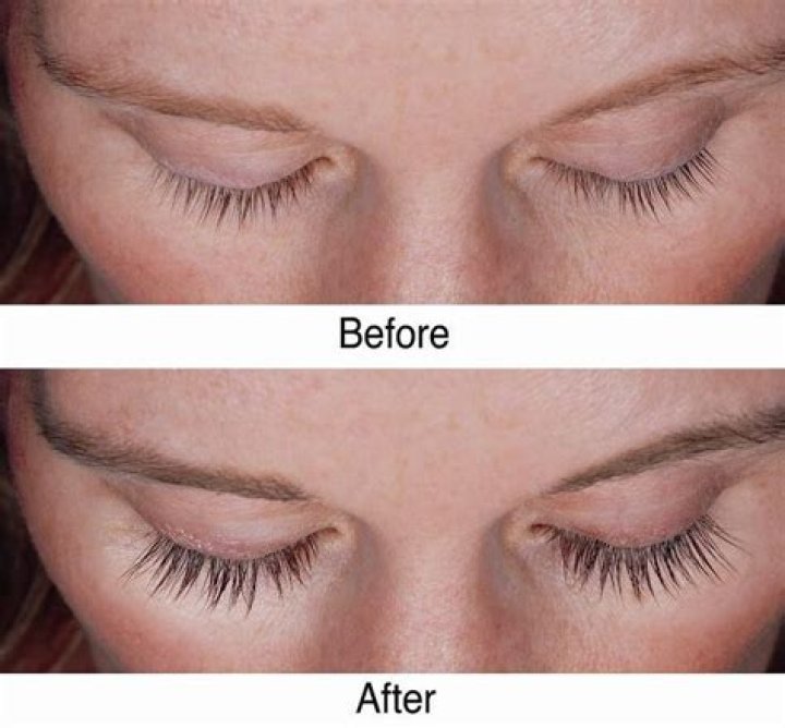 Can Vaseline make your eyelashes grow?