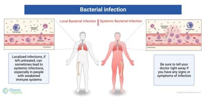 Can water infections cause sepsis?
