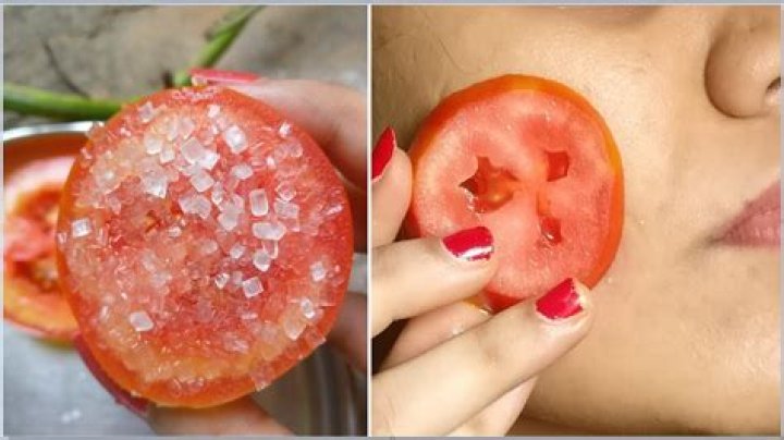Can we apply tomato on pimples?