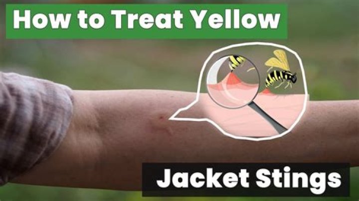 Can yellow jackets sting through clothing?
