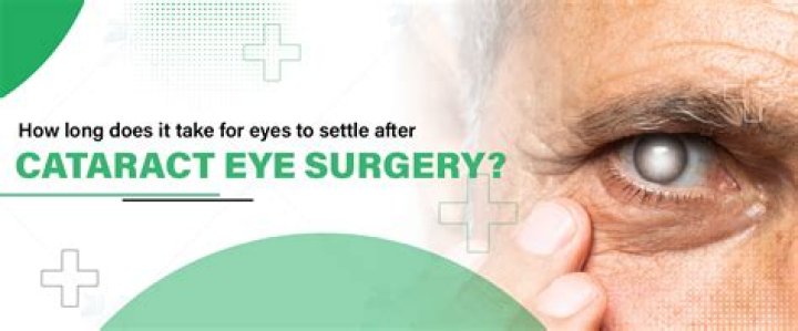 Can you drink coffee after cataract surgery?