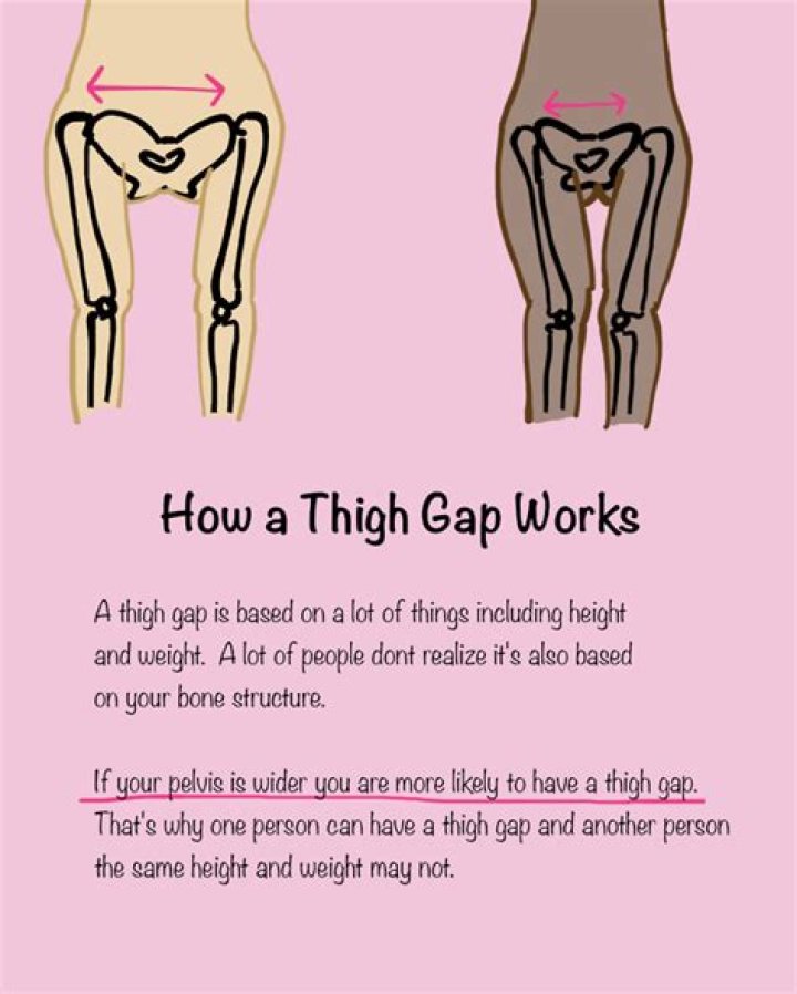 Can you get a thigh gap by starving yourself?