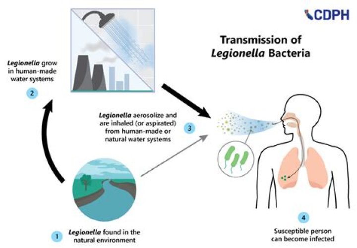Can you get Legionnaires disease from a bath?