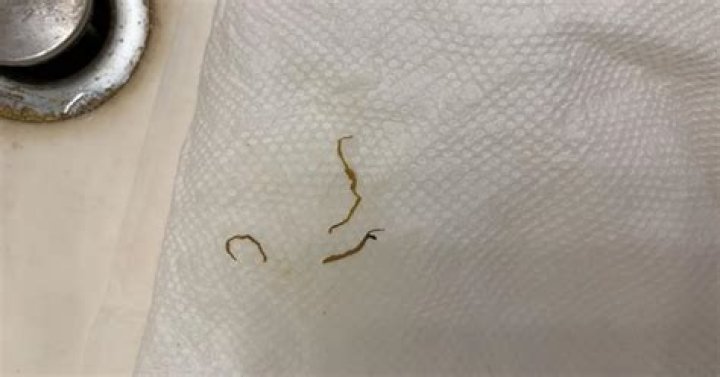 Can you get pinworms from tap water?