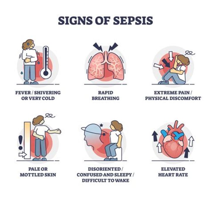 Can you go home from hospital with sepsis?