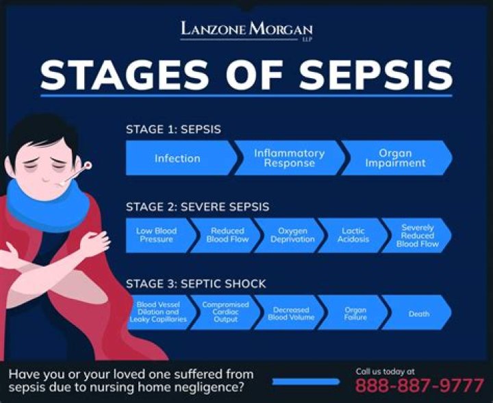 Can you go home with sepsis?
