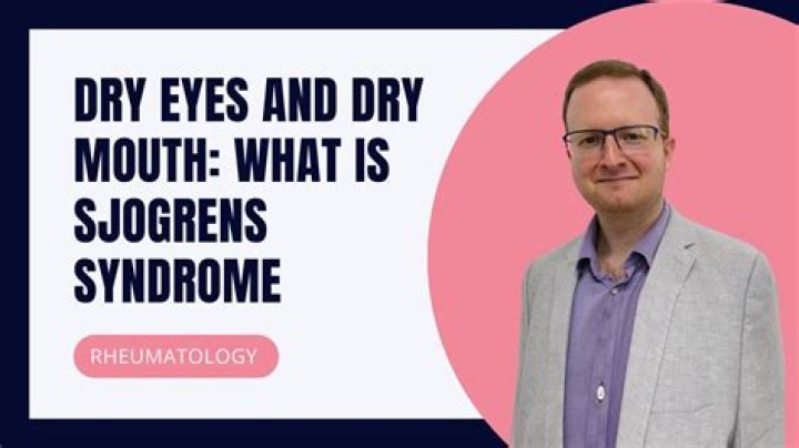 Can you have Sjogren's syndrome without dry mouth?