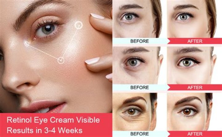 Can you leave retinol on too long?