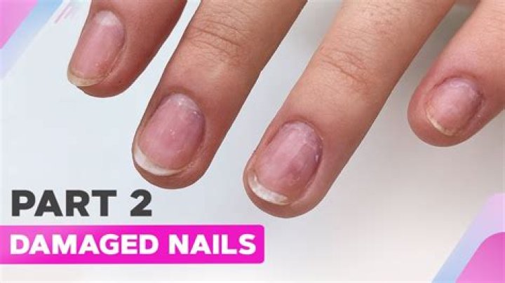 Can you permanently damage your nails?