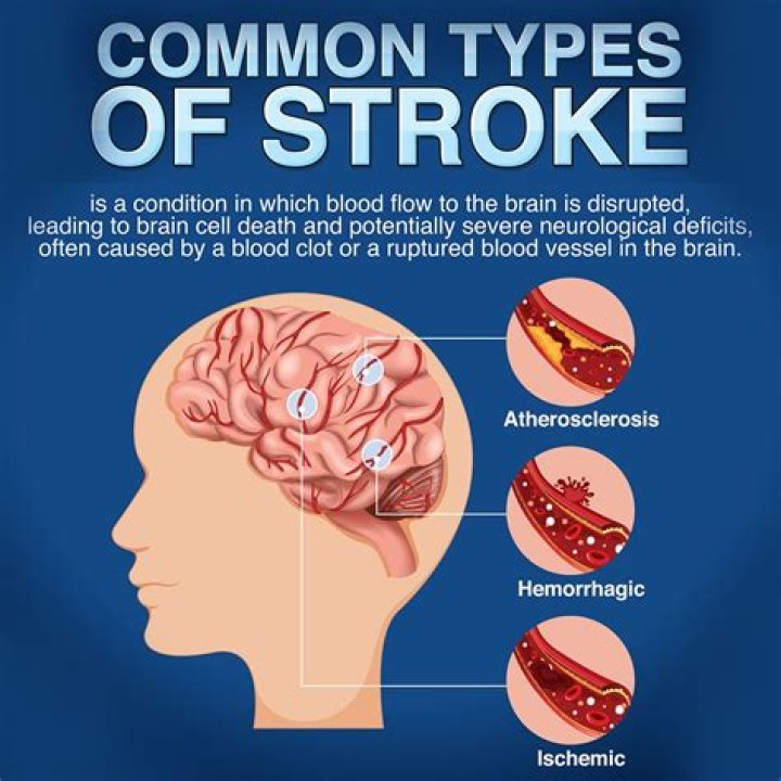 Can you still have a stroke if you are on blood thinners?