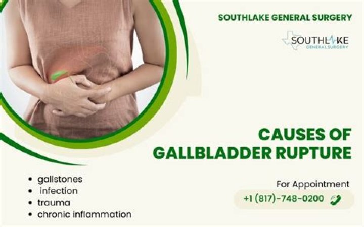 Can you survive a gallbladder rupture?