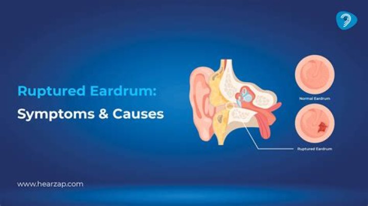 Can you swim with a hole in your eardrum?