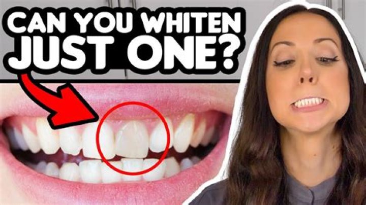 Can you whiten a GREY tooth?