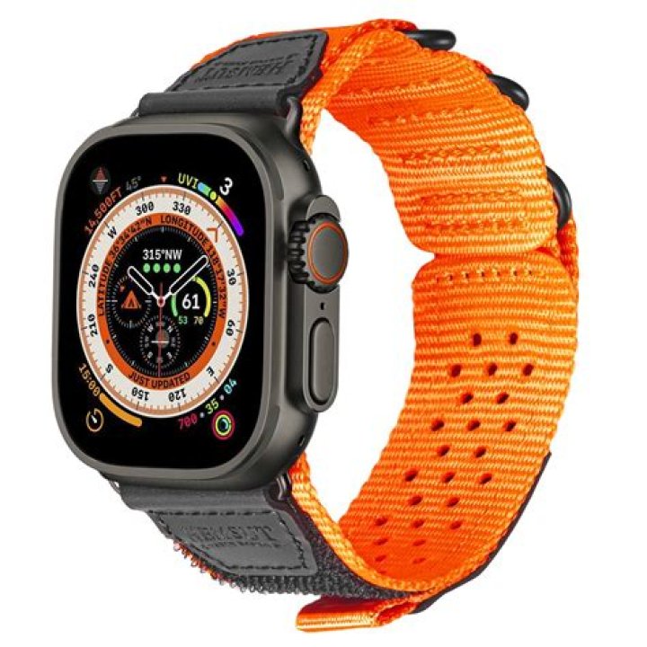 Do Apple Watch bands get dirty?