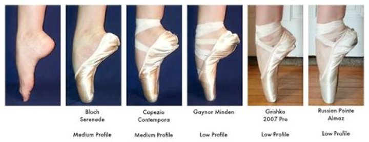 Do ballerinas have flat feet?