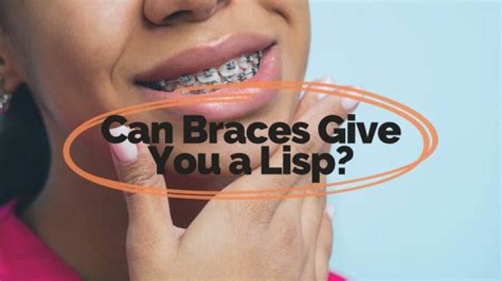 Do braces give you lisp?