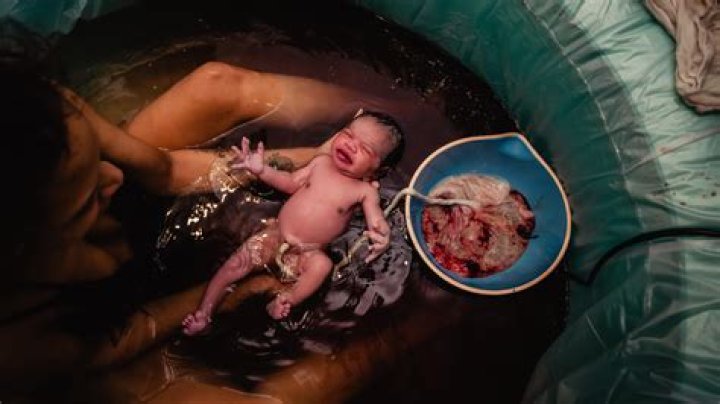 Do cows have afterbirth?