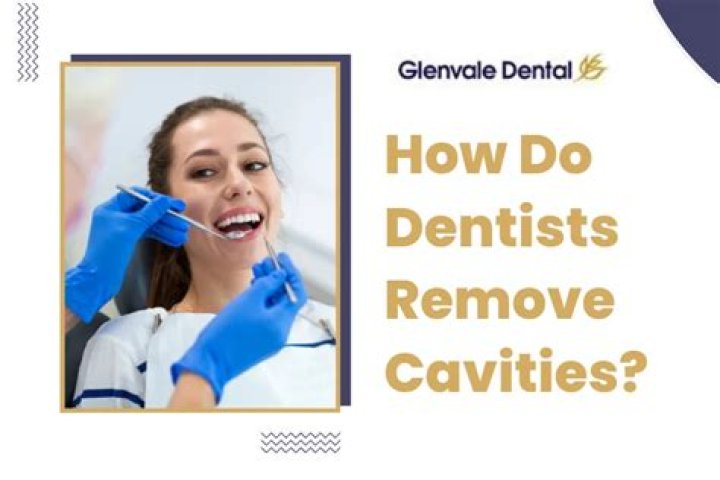 Do dentists ever miss cavities?