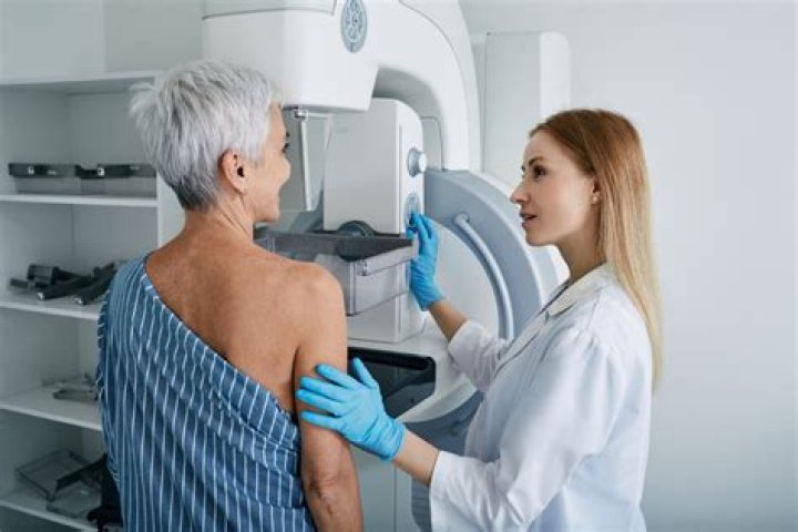 Do I need a mammogram if I had a CT scan?