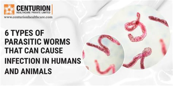 Do most humans have worms?