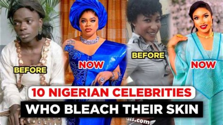 Do Philippines bleach their skin?