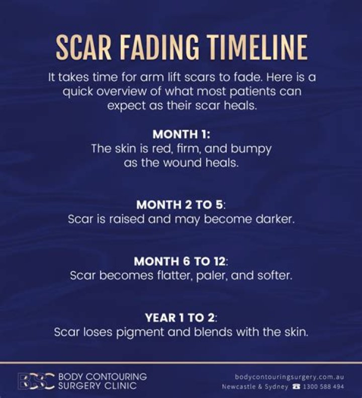Do scars lighten over time?