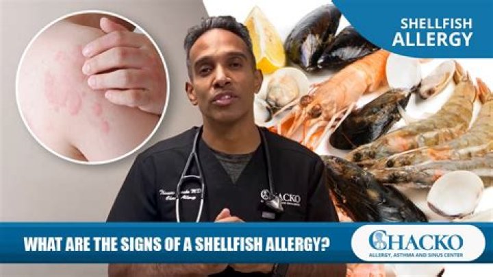 Do shellfish feel pain when boiled?