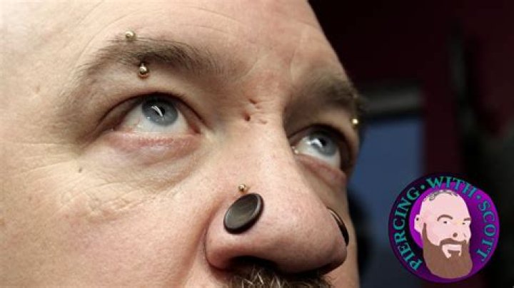 Do Tasers leave scars?