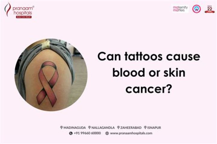 Do tattoos cause sarcoidosis?