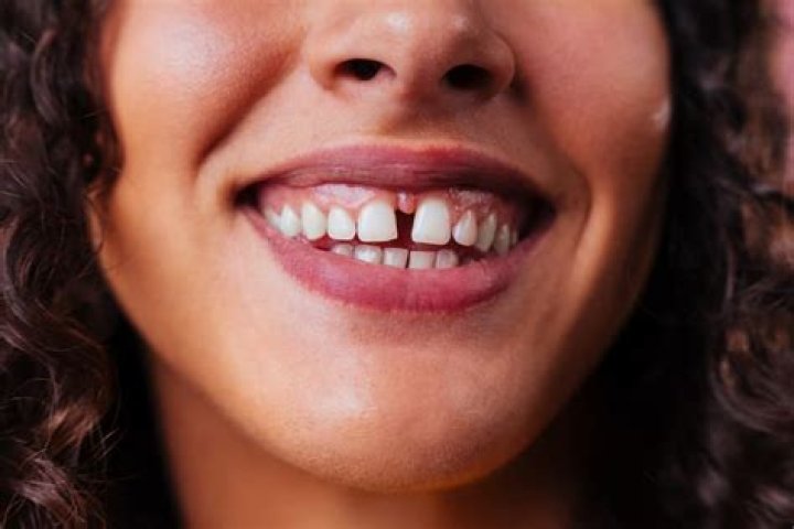 Do teeth get bigger with age?