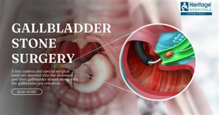 Do they put a tube down your throat for gallbladder surgery?
