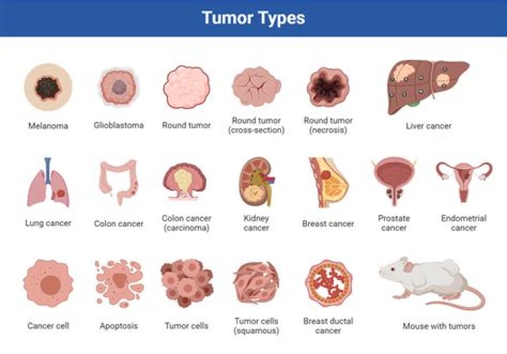 Do tumors hurt when they shrink?