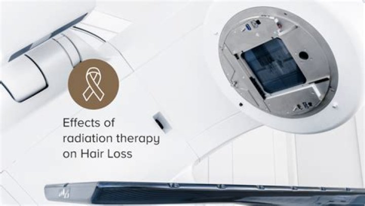 Do you lose hair with radiation?