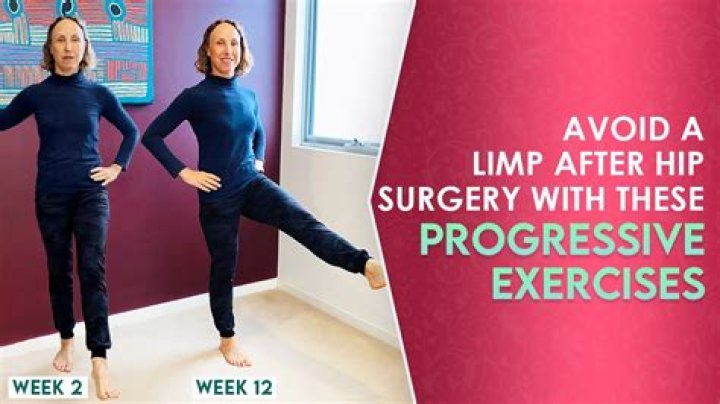 Do you walk with a limp after knee replacement?