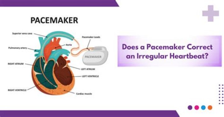 Does a pacemaker make you tired?