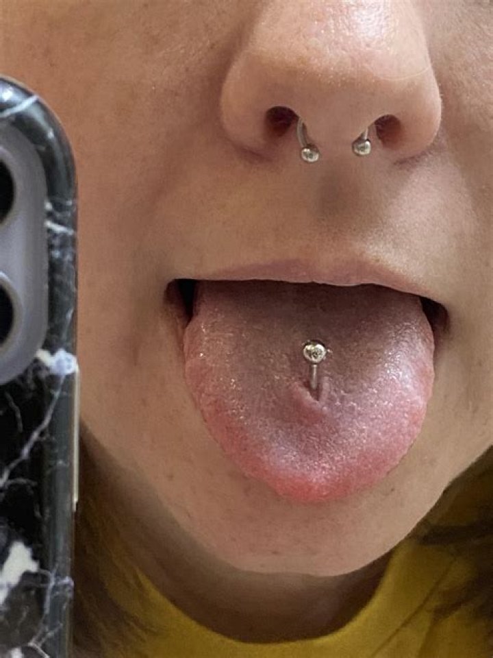 Does a tongue piercing itch?
