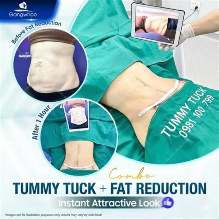 Does a tummy tuck hurt?