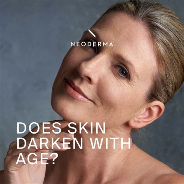 Does Aloe darken skin?