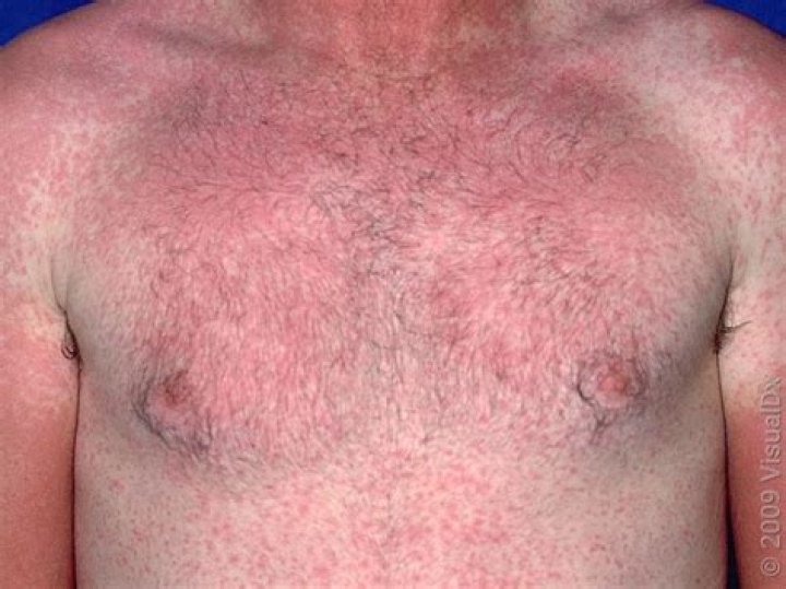 Does anything interfere with Eliquis?