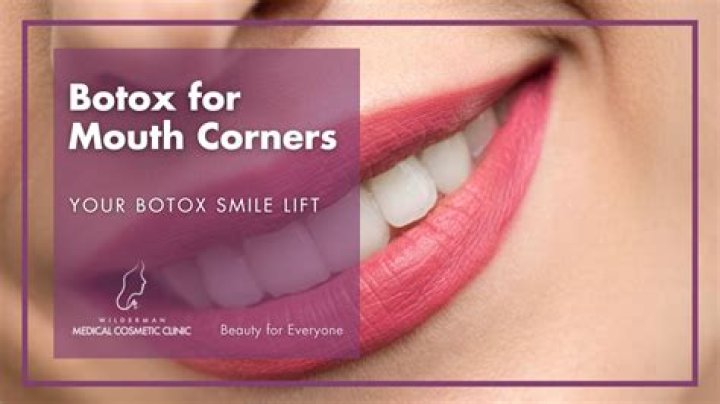 Does Botox help droopy mouth?