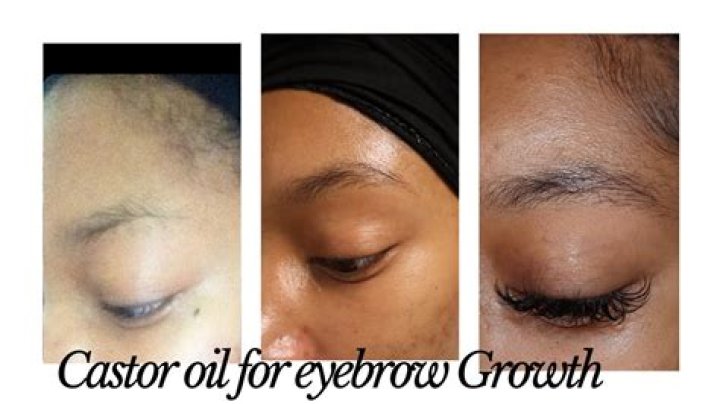 Does castor oil grow brows?