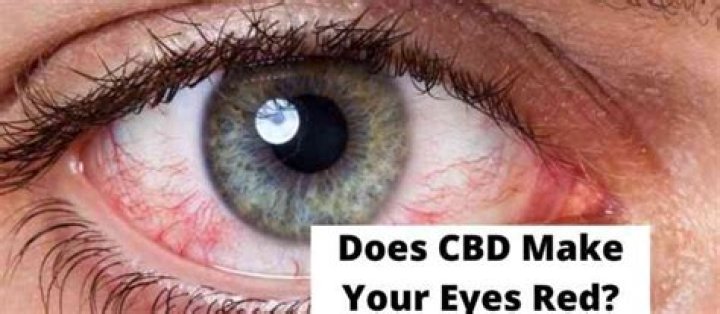 Does CBD make your eyes red?