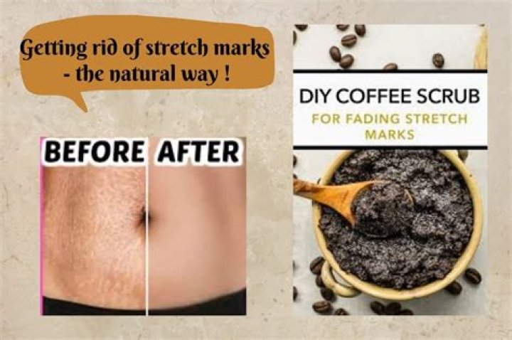 Does coffee scrub help eczema?