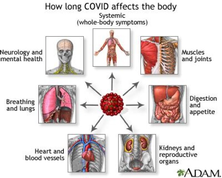 Does Covid affect the bowels?