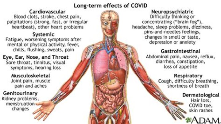 Does COVID affect your back and legs?