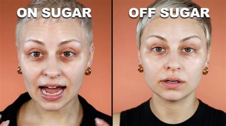 Does cutting down sugar improve skin?